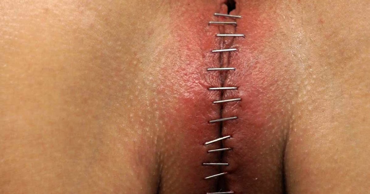 cunt torture