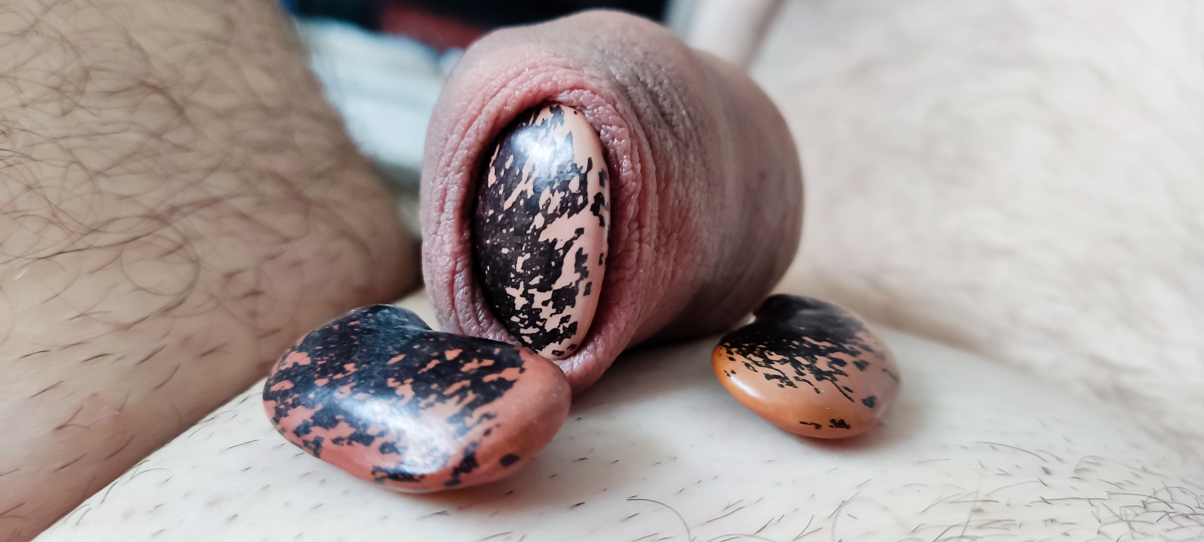 My foreskin play - bean