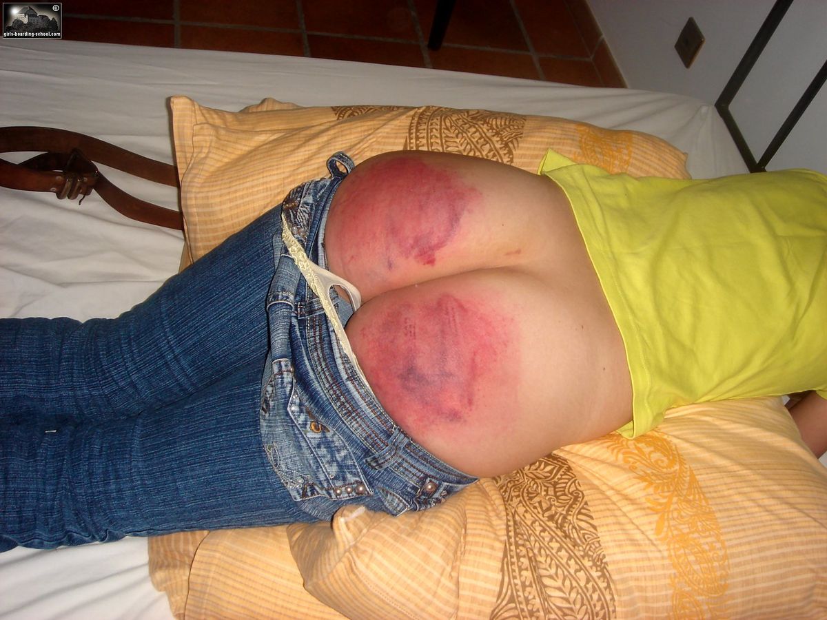 Naked bums must feel the pain