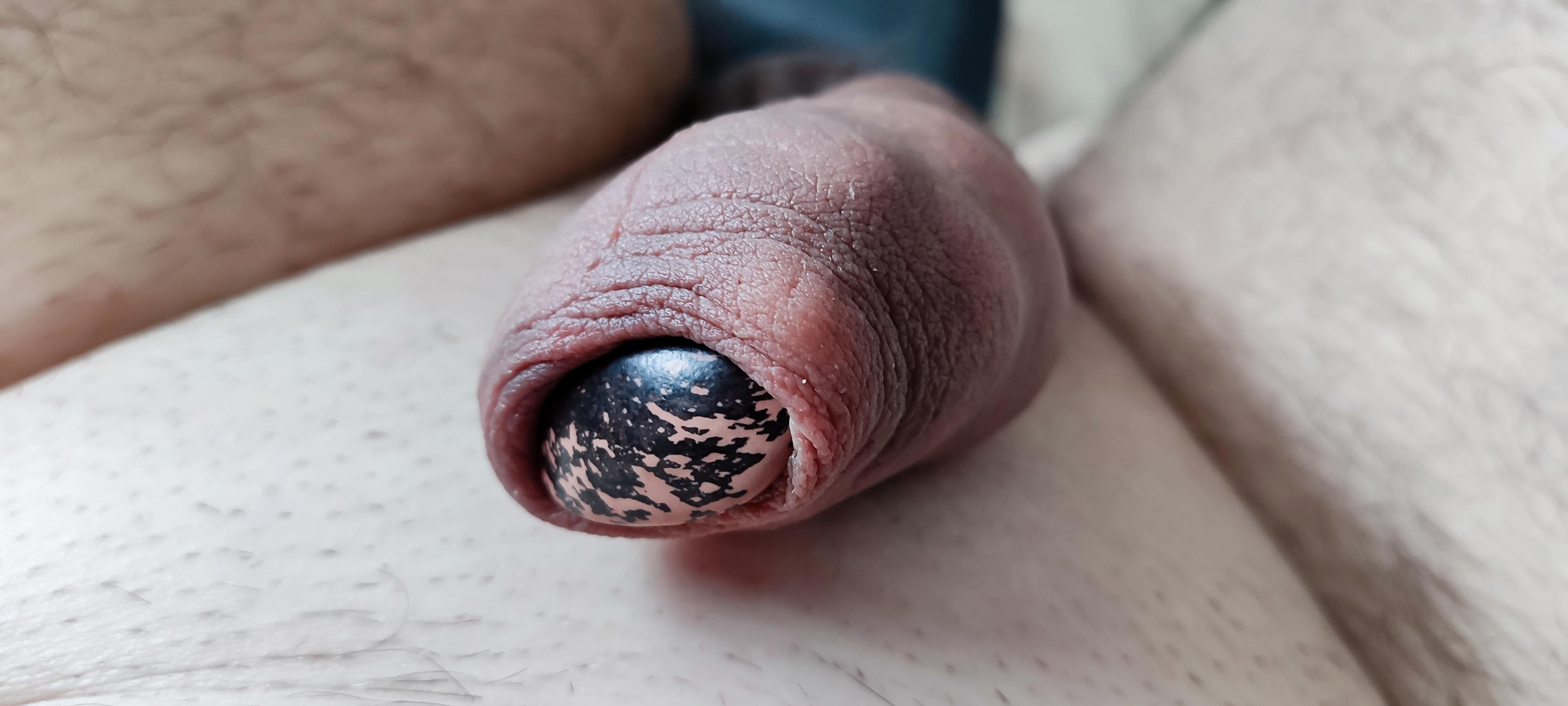 My foreskin play - bean