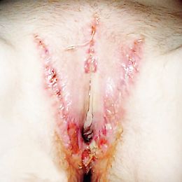 cunt torture