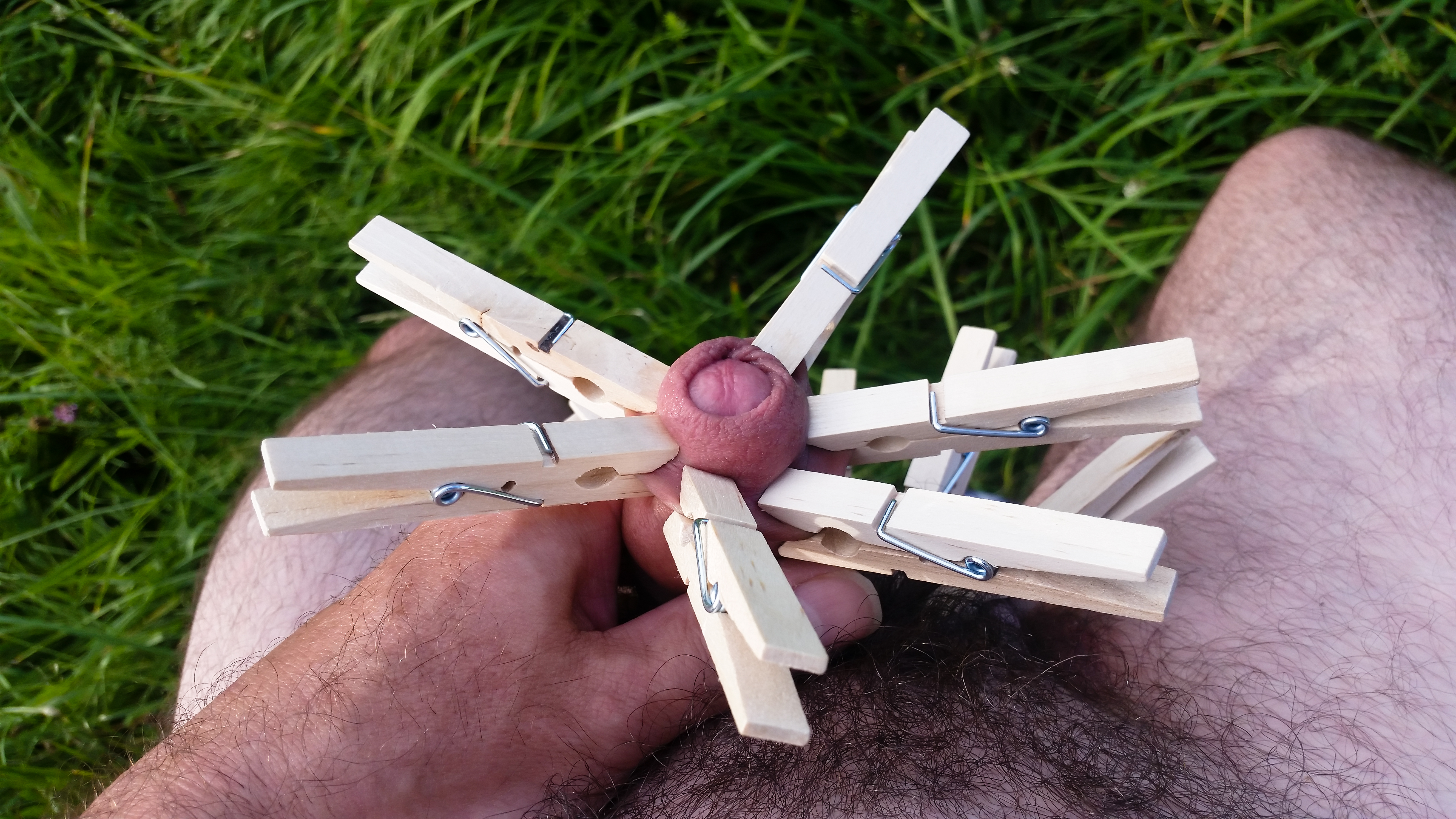 My foreskin with clothes pins